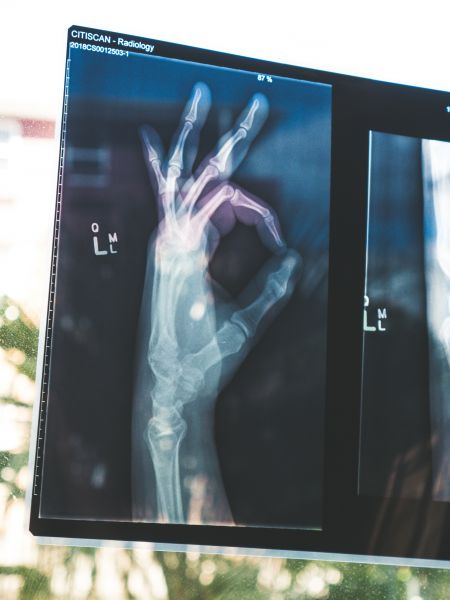 Photo d'une radiographie d'une main faisant un signe OK avec les doigts